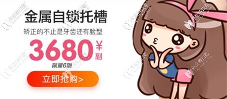 蘭州皓亞口腔金屬托槽矯正優(yōu)惠 蘭州皓亞口腔金屬托槽矯正優(yōu)惠