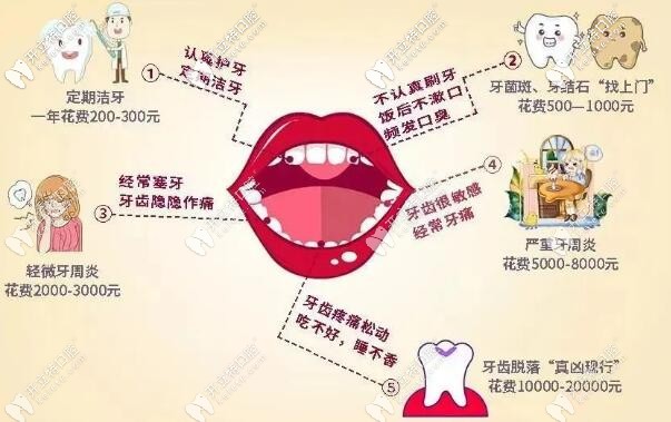看牙的費用好貴