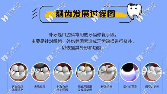 補牙的過程