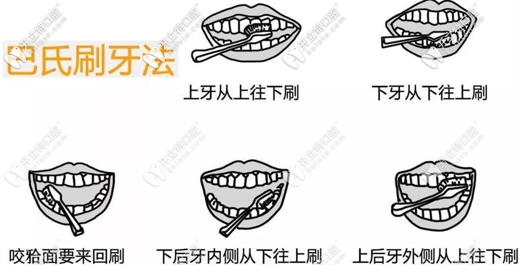 刷牙預(yù)防牙齦萎縮