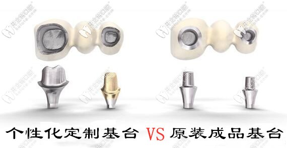 種植牙個(gè)性化基臺和成品基臺的區(qū)別