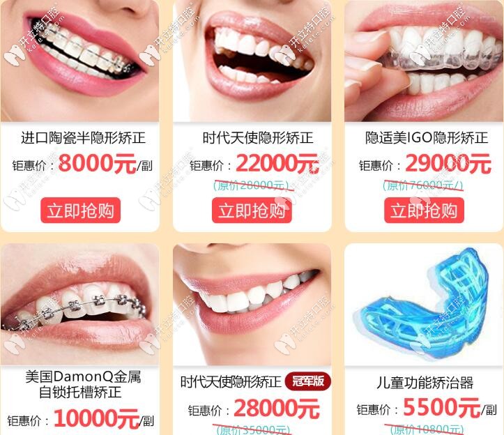 廣州成人牙齒矯正活動價格表