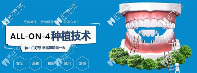 坐標東莞，想做ALL-on-4即刻負重種植牙求推薦靠譜的醫(yī)院！
