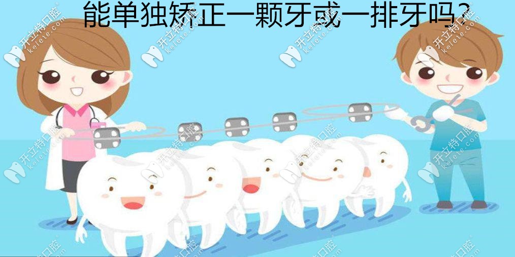 ?牙齒矯正能單獨(dú)矯正一顆歪牙或進(jìn)行一排牙齒正畸嗎？