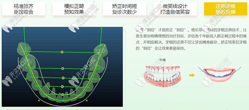 格倫菲爾口腔矯正五大優(yōu)勢(shì)