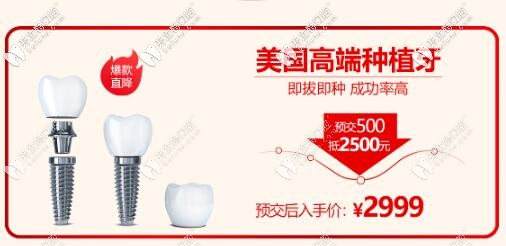 西安諾貝爾口腔門診部美國種植體價(jià)格