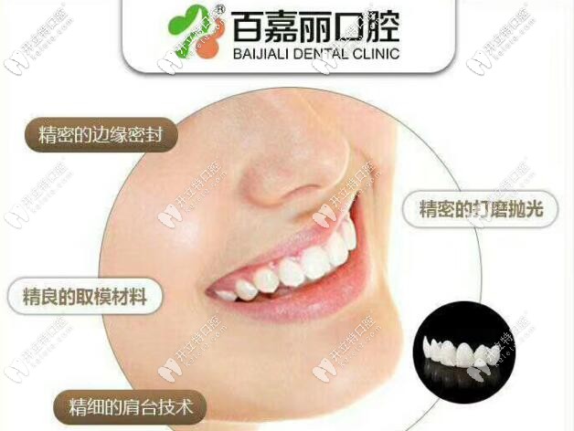 沈陽百嘉麗口腔3D全瓷美容牙冠的優(yōu)勢(shì)