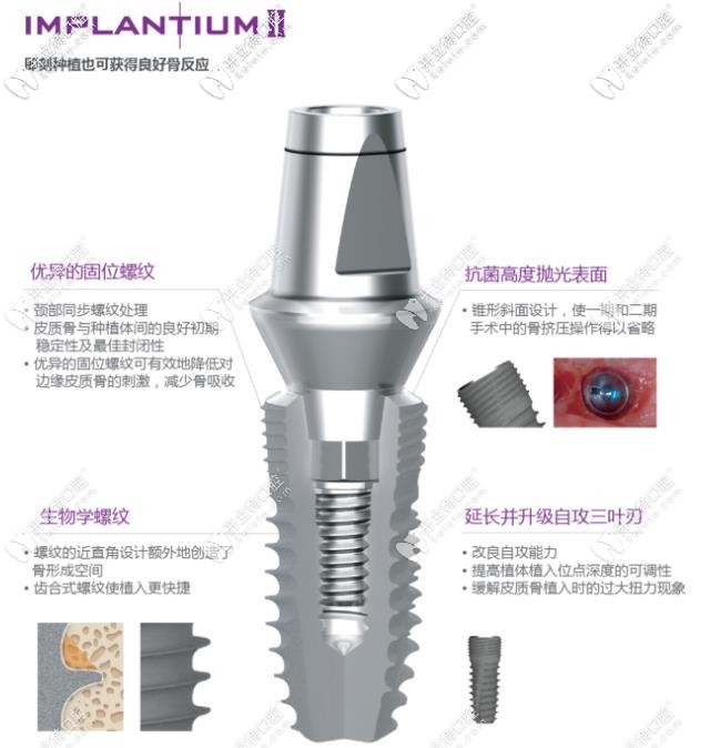 登騰lmplantiumⅡ型號(hào)