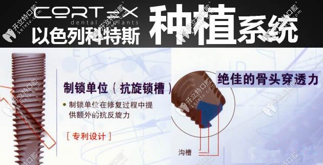 以色列cortex種植體優(yōu)點(diǎn)