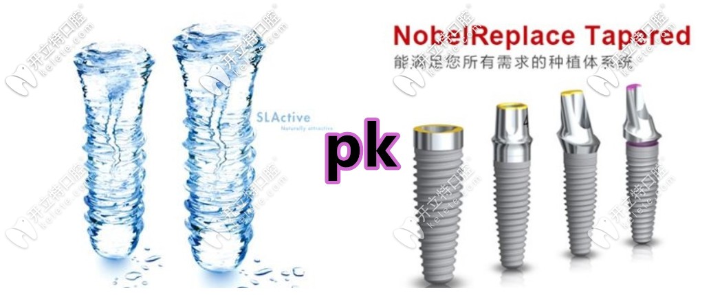 都是上萬的種植牙,諾貝爾active和iti鈦鋯親水種植體哪個更好