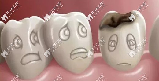 牙齒擁擠不齊可能導(dǎo)致牙齒齲壞
