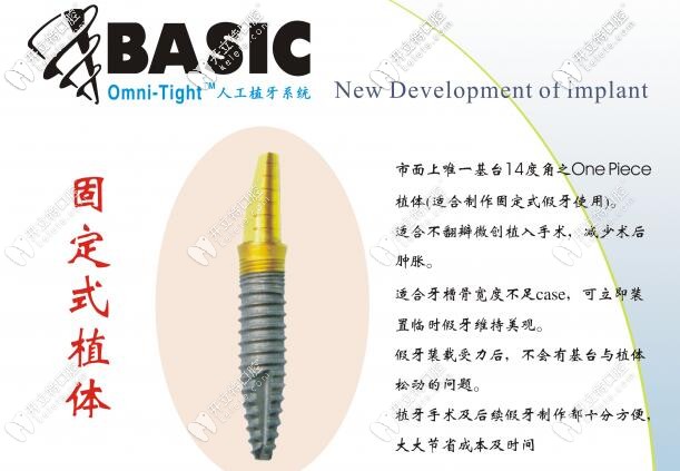 美國Basic固定式植體優(yōu)勢