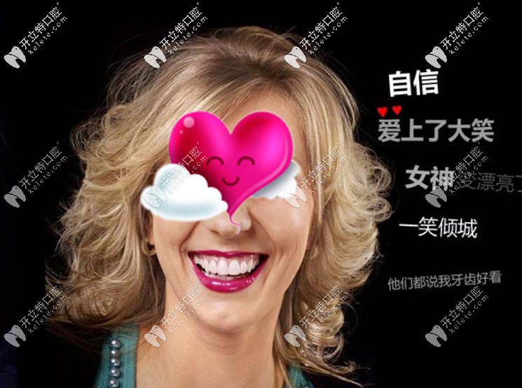 經過DSD微笑設計后做的瓷貼面后