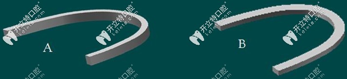 全同步帶狀弓矯正器的優(yōu)缺點(diǎn)