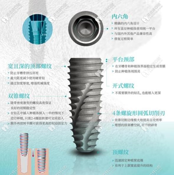 伊諾種植體優(yōu)勢