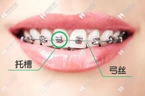 begg矯治技術(shù)的理論基礎(chǔ)