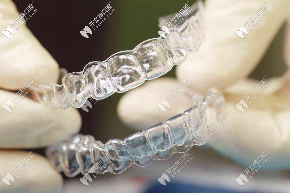 福州隱形牙套價格