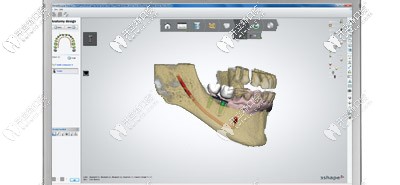 CAD / CAM方案設計