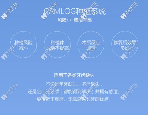 camlog種植體優(yōu)點