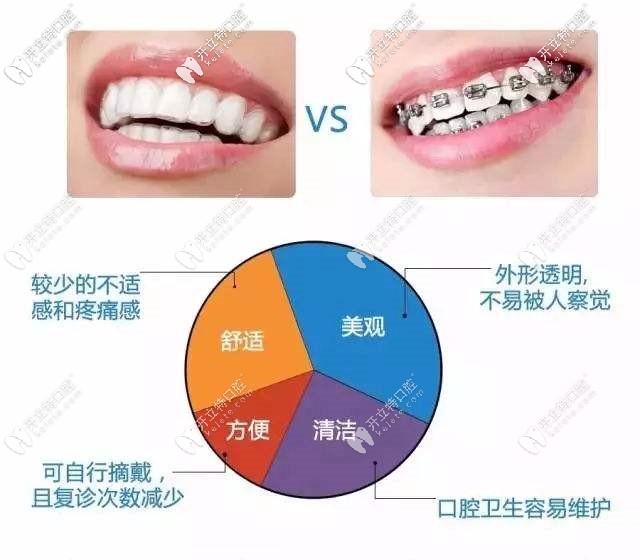 隱形牙套和傳統(tǒng)金屬矯正對比