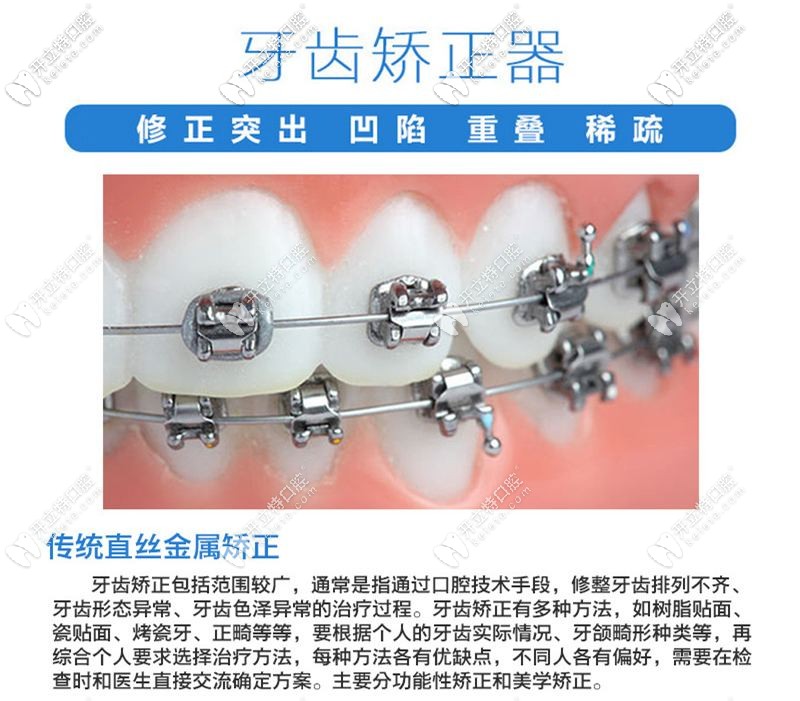 傳統的牙齒矯正