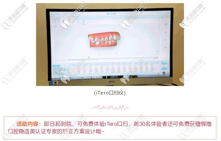 隱適美口掃儀免費體驗啦