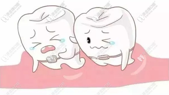 什么情況適合半口矯正呢？