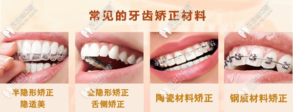 常見的牙齒矯正材料