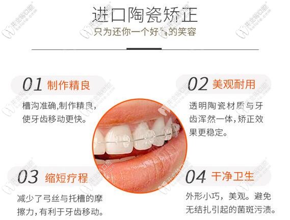 陶瓷半隱形托槽的優(yōu)勢