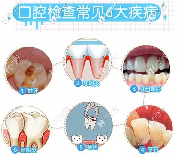 常見(jiàn)的口腔問(wèn)題