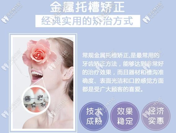 深圳微爾口腔金屬托槽牙齒矯正價格