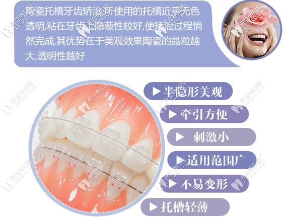 深圳微爾口腔美國3M陶瓷半隱形牙齒矯正價格