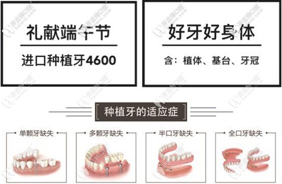 在太原做半口半固定種植牙只需27600元起,這價(jià)格值得了解哦!