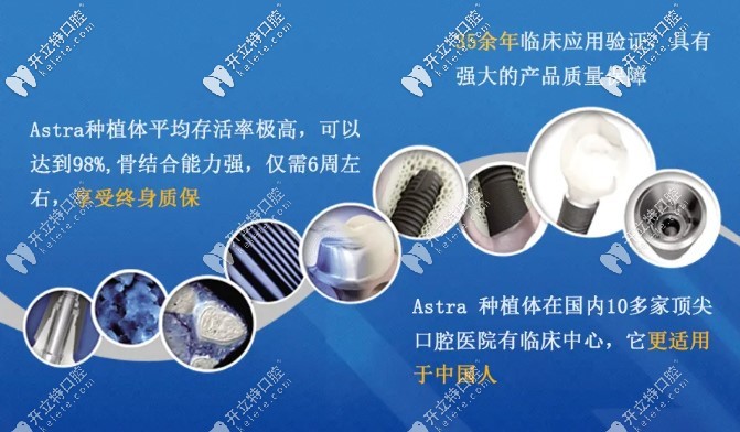 長(zhǎng)沙利爾口腔瑞士Astra種植牙優(yōu)勢(shì)