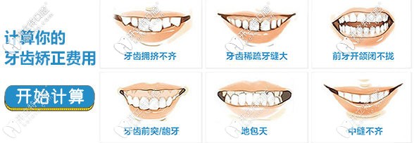 想在洛陽做隱形矯正的朋友速來關(guān)注隱適美隱形牙套價(jià)格吧