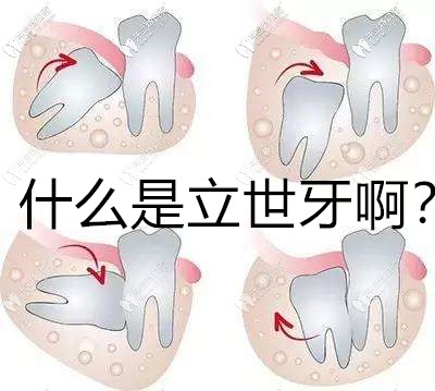 立世牙到底拔還是不拔?什么時(shí)候拔比較好及價(jià)格你都要知道