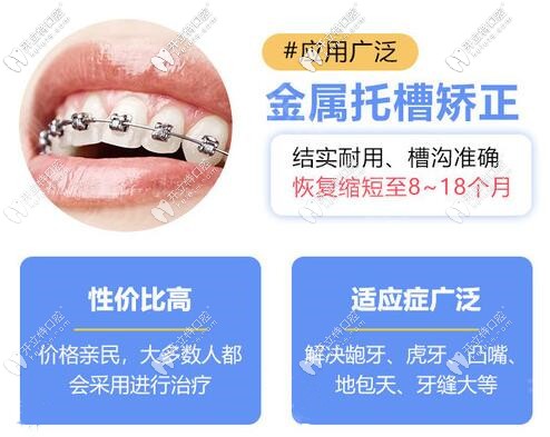 蘇州金屬托槽牙齒矯正價格