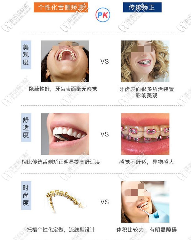 個(gè)性舌側(cè)隱形矯正和傳統(tǒng)矯正對比