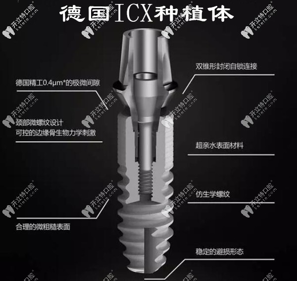德國ICX種植體有幾種型號