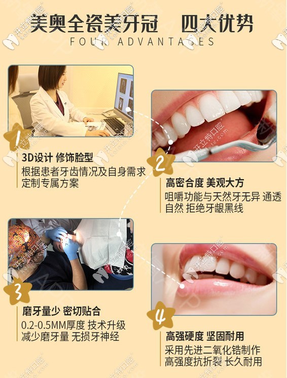 重慶美奧牙科全瓷冠優(yōu)勢圖