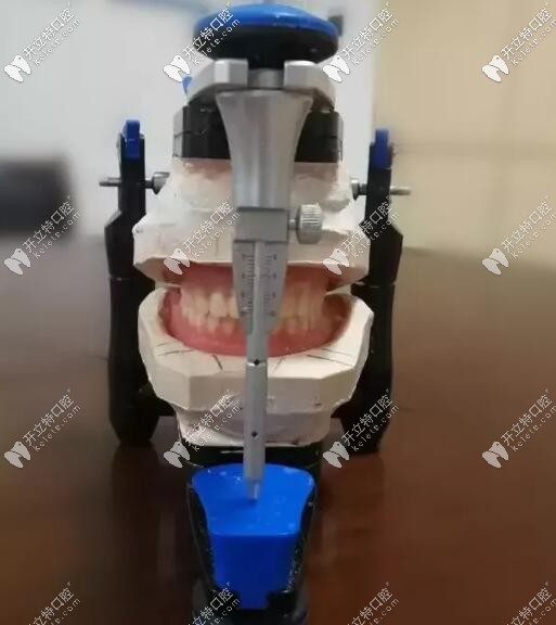 吸附性義齒的制作