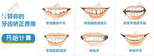 計算牙齒矯正的費用