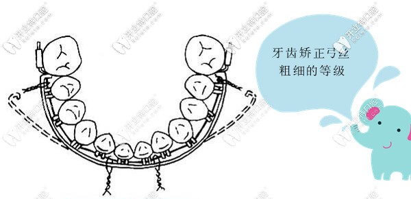 牙齒正畸的弓絲粗細(xì)等級