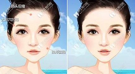 臉部凹陷圖片