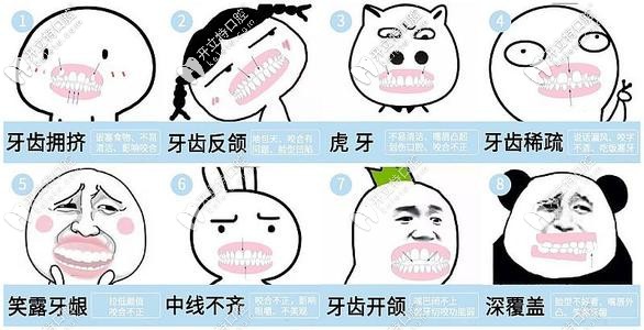 有這8種情況就要考慮矯正啦