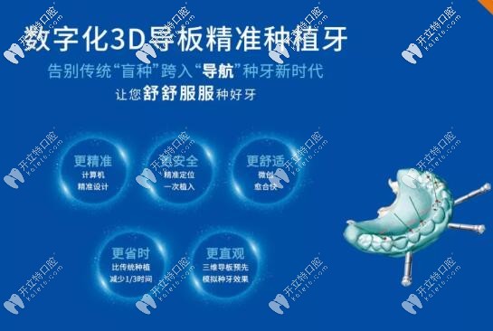 3d導(dǎo)板精準快速種牙