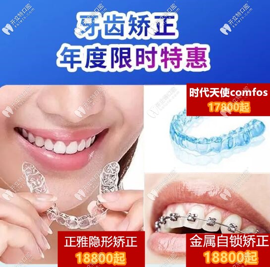 武漢壹加壹口腔牙齒矯正價格 武漢壹加壹口腔牙齒矯正價格