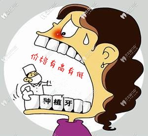 缺牙必知:在上海私立醫(yī)院做韓國登騰純鈦種植牙多少錢一顆