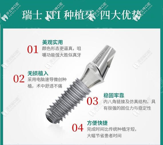 深圳河山口腔門(mén)診部瑞士ITI種植牙優(yōu)勢(shì)