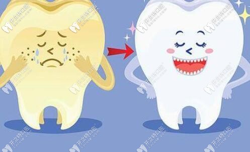 牙齒發(fā)黃怎么辦